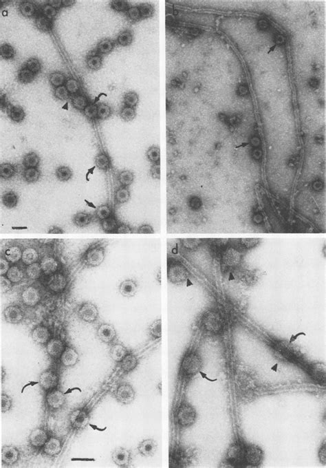 What are the symptoms of a norovirus infection? Electron micrographs of (a) reovirus type 1 with type 1 ...