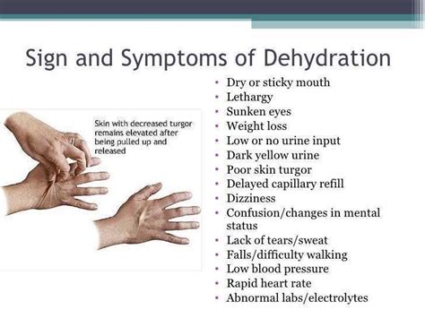 Pin By Alan Buddy Henderson On Med Dehydration Symptoms Dehydrator