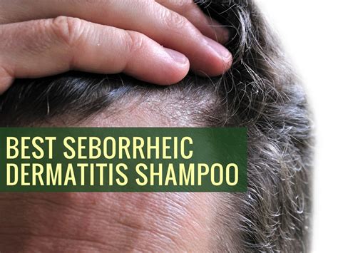 Best Seborrheic Dermatitis Shampoo For Scalp Review Tips And Advice