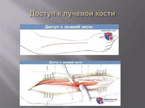 Диета при плечевом артрите