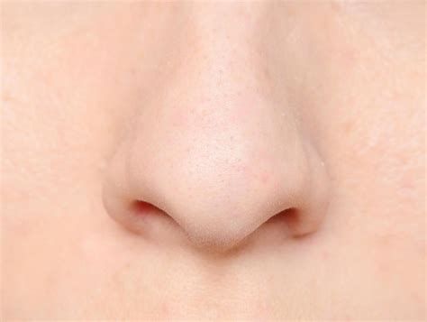 Skin Cancer On Nose Signs