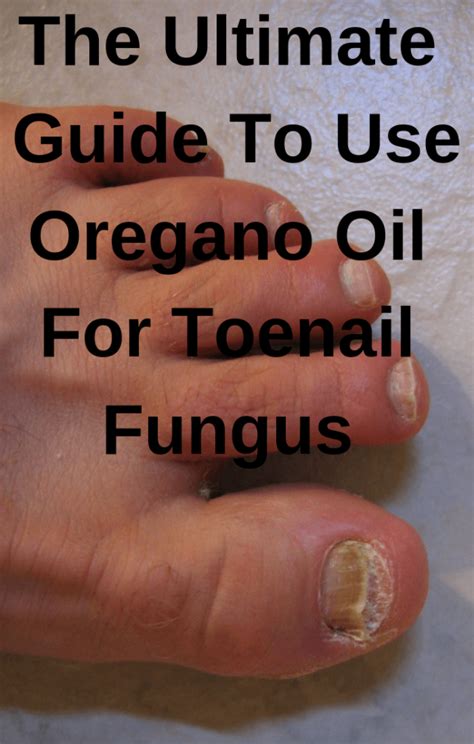 Best Oregano Oil For Toenail Fungus In 2021 And Beyond Toenail