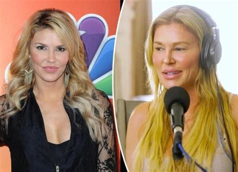 Brandi Glanvilles Bad Plastic Surgery 2024 View Before And After Photographs