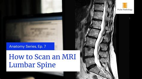 How To Scan An Mri Lumbar Spine Youtube