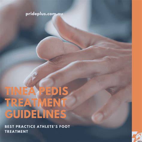 A Podiatrists Tinea Pedis Treatment Guidelines Simple Fix