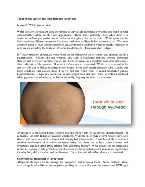 Pdf Treat White Spot On The Skin Through Ayurveda Keyword White Spot