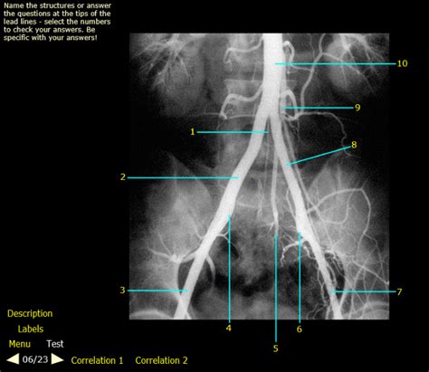 Pelvis 6 Iliac Arteries Angiogram Part 1 Diagram Quizlet