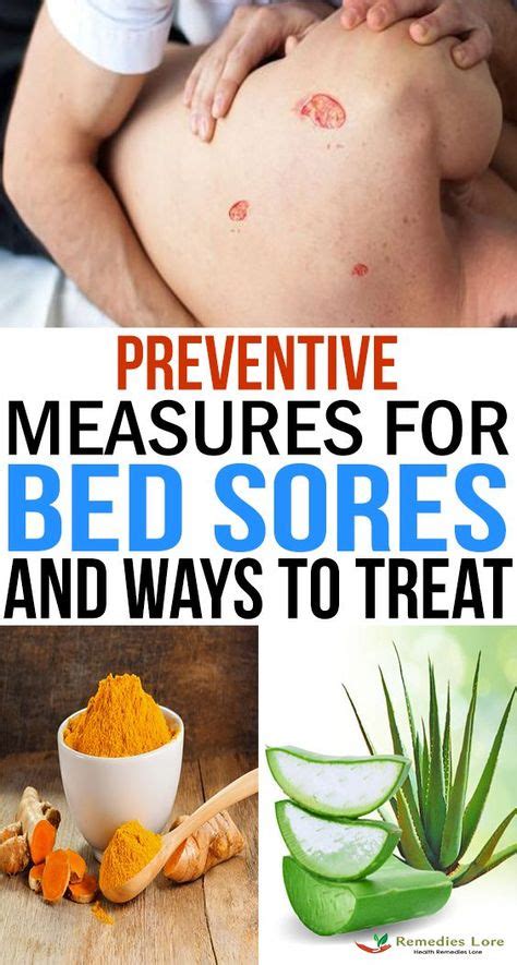 Bed Sores Also Called As Pressure Sores Happens When The Skin