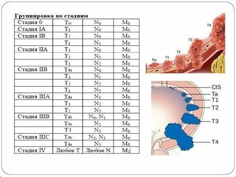 Рак желудка 4 стадии диета Рак желудка. Патология и стадии опухолевого процесса - online presentation Рак желудка. Патология и стадии опухолевого процесса - online presentation Рак желудка 4 стадии диета