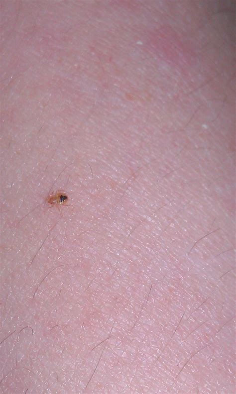 How To Identify Bedbugs And Distinguish Them From Other Pests Bed Bug