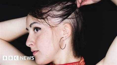 Flamenco Dancer 25 Opens Up About Alopecia Hair Loss Bbc News