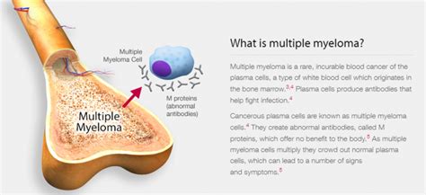 The Above Figure Is From Myeloma Explained Resource 1 Below