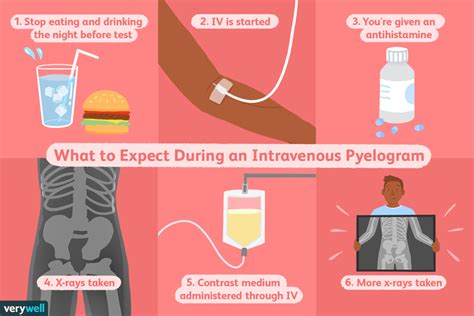 Intravenous Pyelogram Uses Side Effects Procedure Results