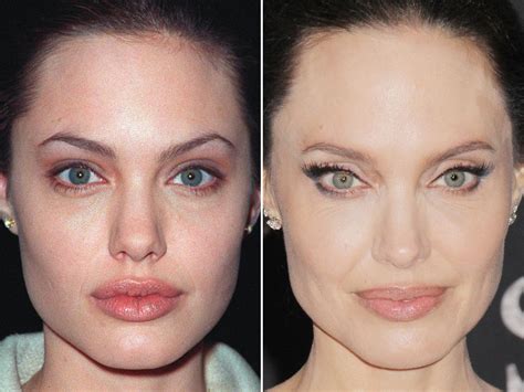 Angelina Jolie Before And After Angelina Jolie Angelina Jolie Lips Angelina Jolie Eyes