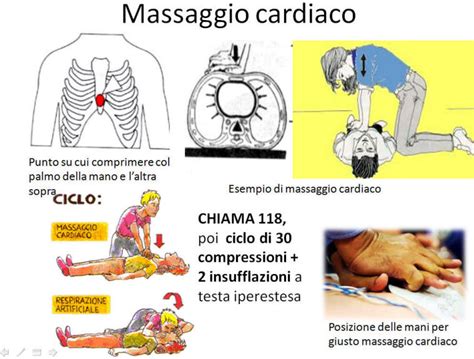 Necessario Metodo Trattamento Massaggio Cardiaco Da Soli Peggiorando Densità Catalogare