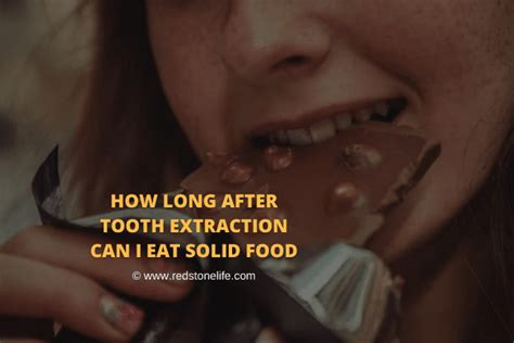 How Long After Tooth Extraction Can I Eat Solid Food Lets Find Out