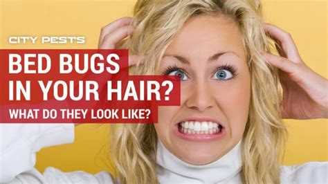 Bed Bugs In Hair Symptoms Pictures And Treatment For Bugs In Hair