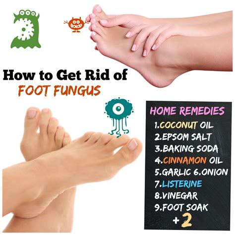 How To Get Rid Of Foot Fungus Home Remedies 1coconut Oil 2epsom Salt