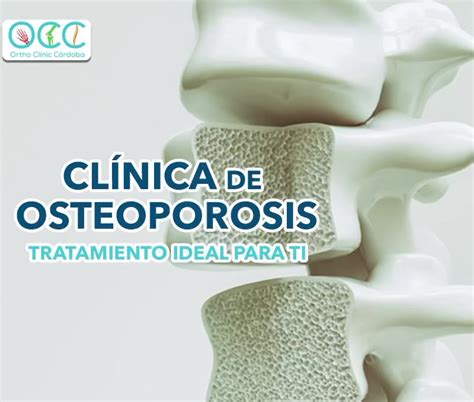 La Osteoporosis Es Una Enfermedad Que Adelgaza Y Debilita Los Huesos
