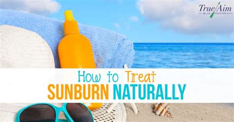 Easy And Simple Ways To Treat Sunburns Naturally