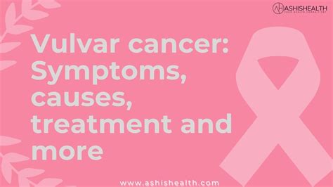 Vulvar Cancer Symptoms Causes Treatment And More