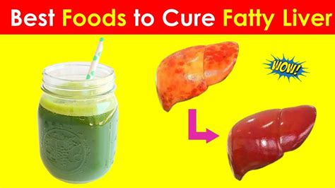 9 Must Have Foods To Eat And Avoid During Fatty Liver Fatty Liver Diet