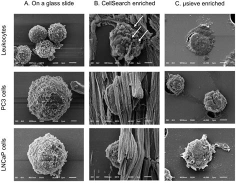 Cancer Cell Scanning Electron Microscopy Cancer