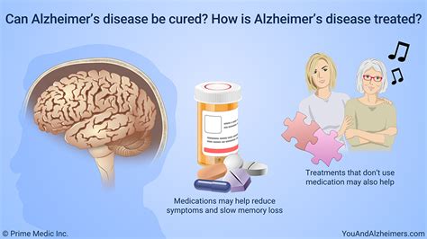 Slide Show Managing And Treating Alzheimers Disease