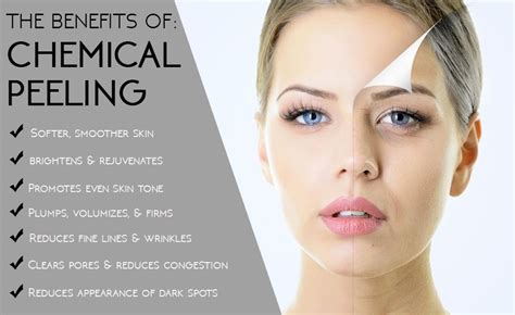Glycolic Chemical Peel Living Young Center