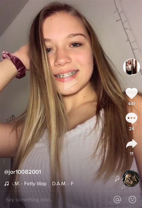 Pin On Jessica Teen With Braces