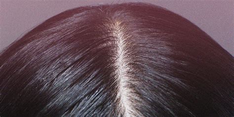 How To Get A Healthy Scalp What Does A Healthy Scalp Look Like