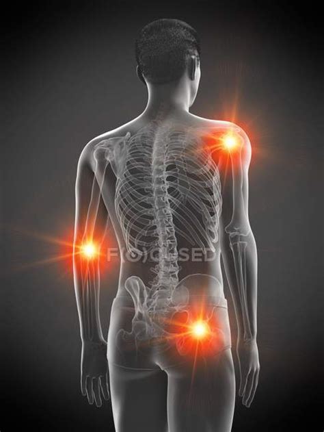 Human Body With Points Of Joint Pain Conceptual Illustration Injury