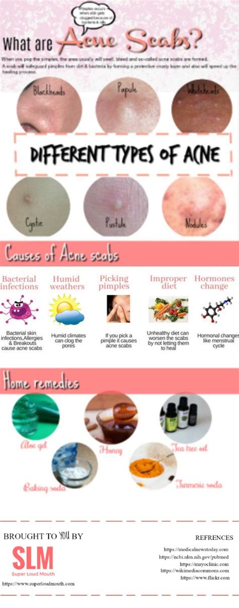 40 Best Ways To Get Rid Of Acne Scabs Overnight Diy Home Remedies