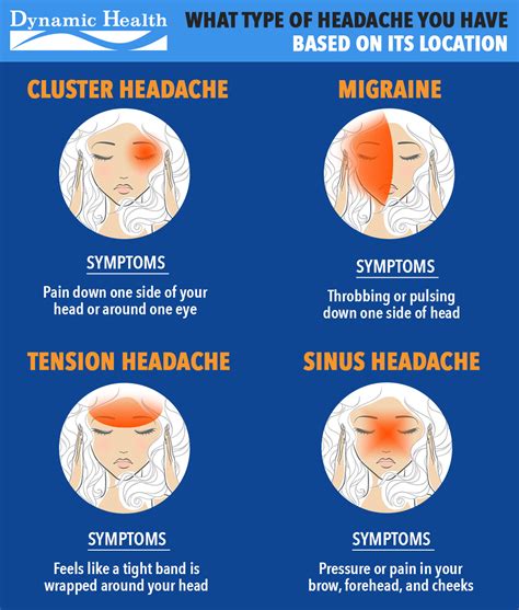 Types Of Headaches Chart By Location