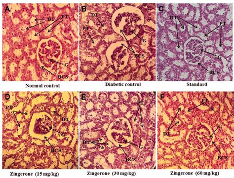 Microscopic Observations Of Hande Stained Kidney Sections 400 ×