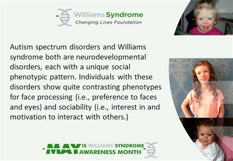 Williams Disease Symptoms