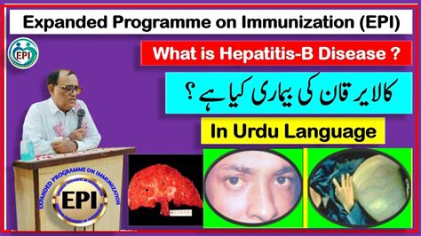 WHAT IS HEPATITIS B DISEASE HEPATITIS B In Urdu YouTube