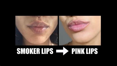 Lighten Dark Smoker Lips Fast Youtube
