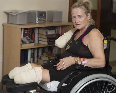 Scheme Star Annie Caddis Learns To Drive Again After Losing Three Limbs To Sepsis And Triple