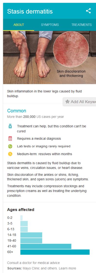 Stasis Dermatitis Eczema On Legs Causes And Treatment Stasis