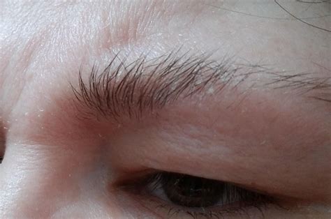 Flaky Eyebrows And Skin Help R30plusskincare