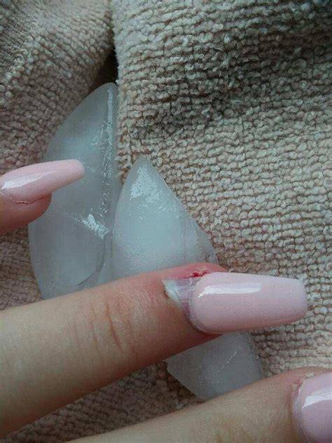 Hit My Acrylic Nail Resulting In Lifting My Real Nail And I Believe