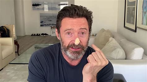 Hugh Jackman Undergoes Skin Cancer Tests And Encourages Sun Safety