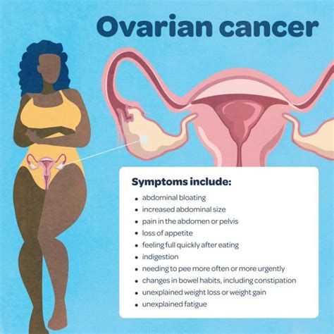 What Is Gynaecological Cancer And What Are The Symptoms Cancercuretoday