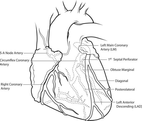 Artery is a blood vessel that takes blood away from the heart to blood flow heart diagram elegant this chart shows the arteries present in the thoracic upper limb. Cardiothoracic Surgery: Diseases Of The Heart, Great ...
