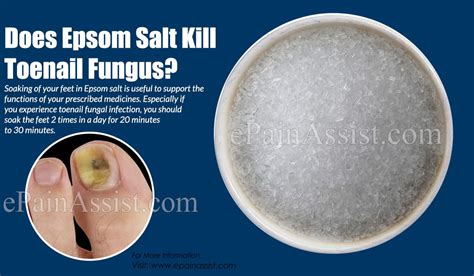 Epsom Salt Vs Table For Infection Elcho Table