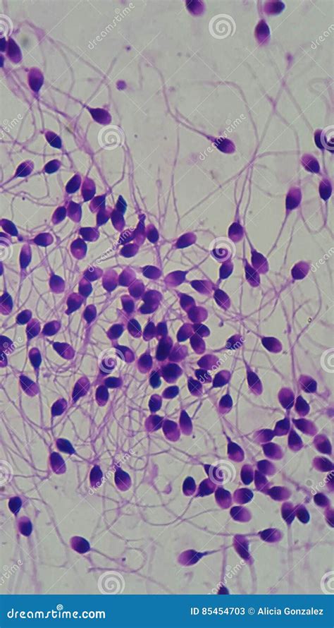 sperm morfology test 1000x stock image image of morphology 85454703