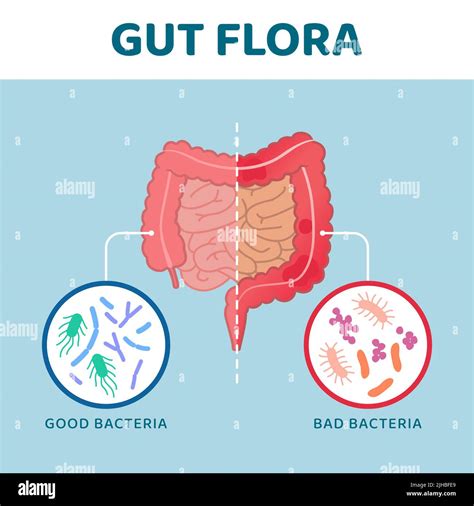 Good And Bad Gut Bacteria Comparison Between Healthy Intestine And