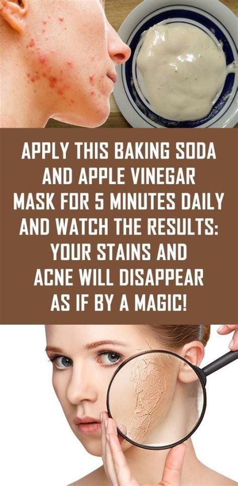 Apply This Baking Soda And Apple Vinegar Mask For 5 Minutes Apple