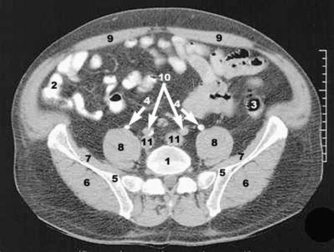 Ct Physics 09 Cross Sectional Ct Images Of The Abdomen